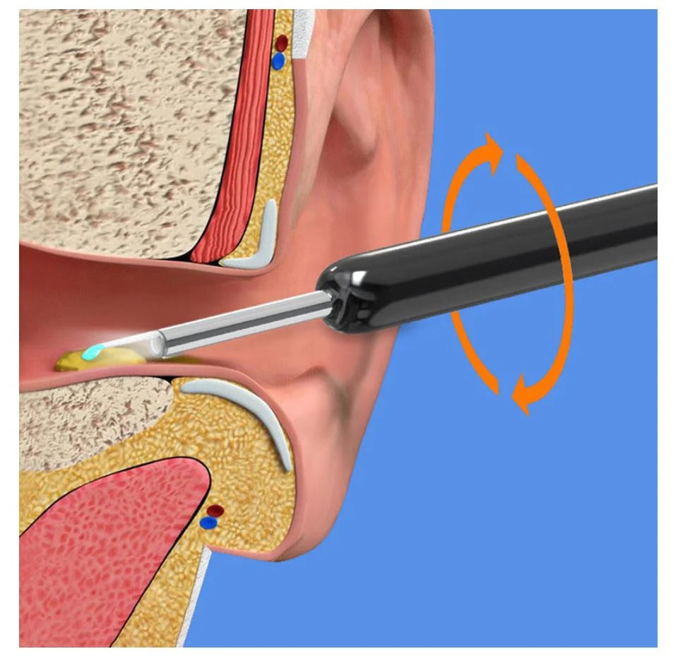 Smart Ear Kit – Safe & Effective